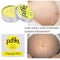 Shonlo | Maternity Removal Stretch Marks Cream 